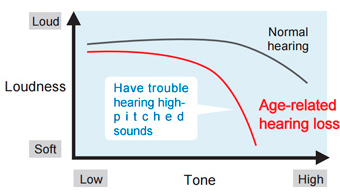 Figure 1: Frequency sensitivity in 
age-related hearing loss